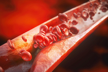 Cardiac catheterization